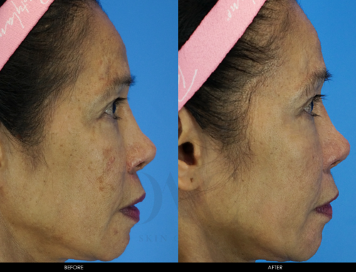 PIGMENTATION IMPROVEMENT 5