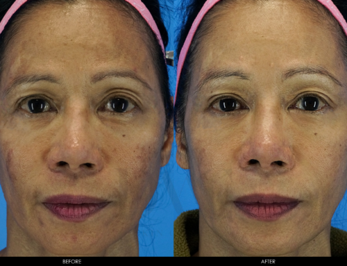 PIGMENTATION IMPROVEMENT 3