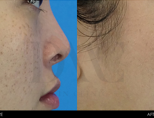 PIGMENTATION IMPROVEMENT 5