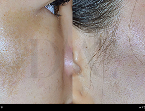 PIGMENTATION IMPROVEMENT 5