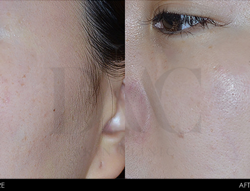 PIGMENTATION IMPROVEMENT 2