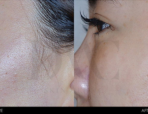 PIGMENTATION IMPROVEMENT 1